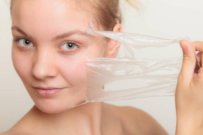 Chemical Skin Peels